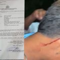 Diduga Jadi Korban Pengeroyokan Di Alun-alun Kelet, Pemuda Asal Cluwak Resmi Adukan Kasus ke Polres Jepara